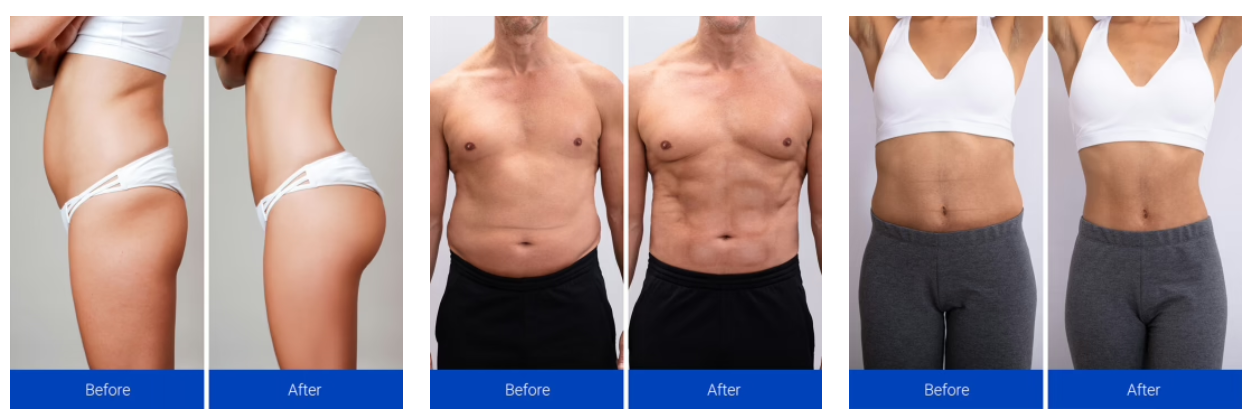 NavaMax ABS Stimulator customer reviews