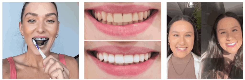 WellaWhite Teeth Whitening Foam results